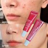 Kem chấm mụn Biotrade Acnaut Active Cream 5g giảm sưng viêm gom cồi nhanh cho da dầu mụn Biocelluxe
